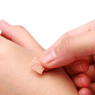 GB 2024-2016 Иглы-кнопки для акупунктуры 0,2 мм x 1,5 мм для аппаратов китайской медицины. Стандарт безопасности