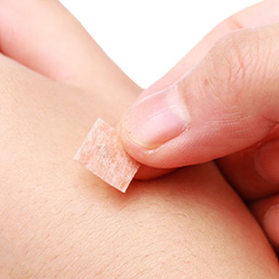 Острые иглы из нержавеющей стали для акупунктуры для точной работы